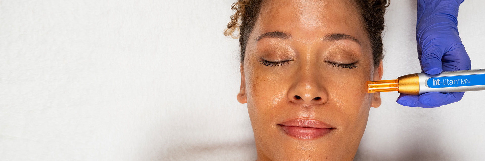 Microexfoliation