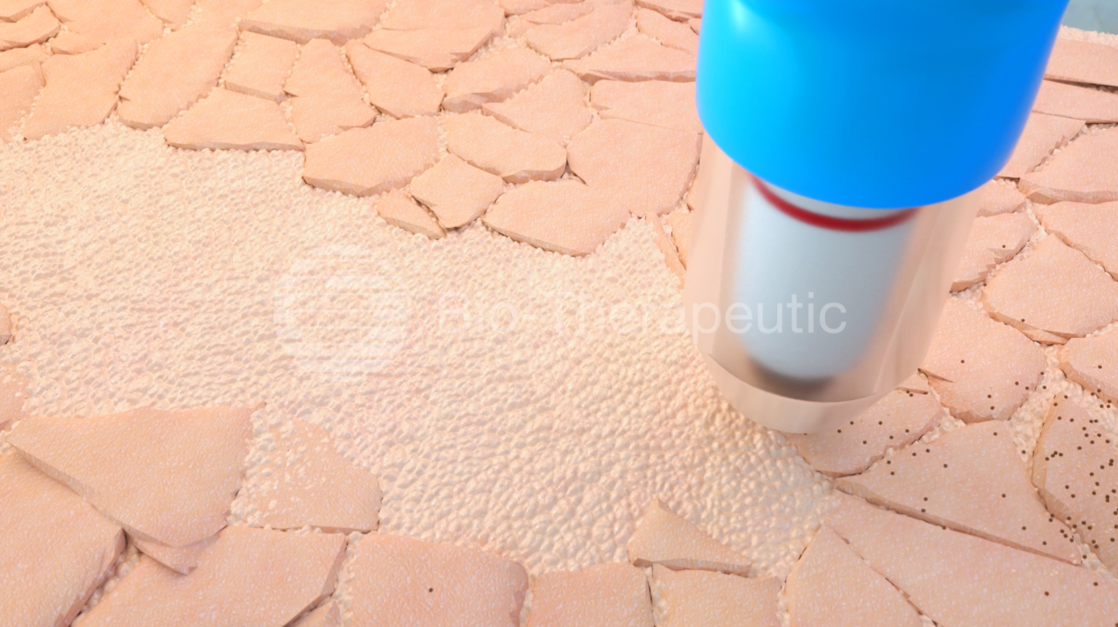 Bio-Brasion Trinity: Truly Bespoke Wet/Dry Microdermabrasion – Bio ...