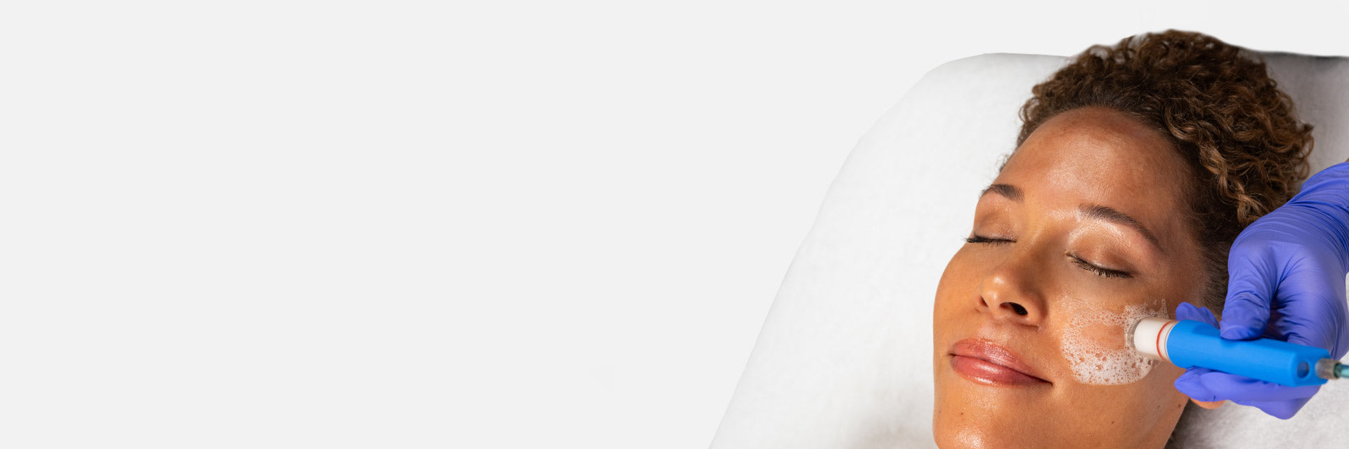 Wet/Dry Microdermabrasion