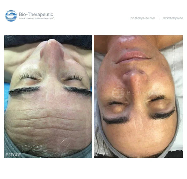 bt-nano + FREE bt-sculpt PRO package