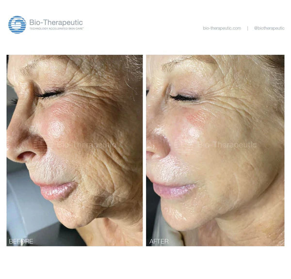 bt-nano + FREE bt-sculpt PRO package