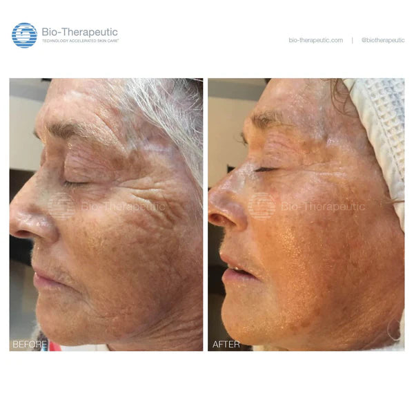 bt-nano + FREE bt-sculpt PRO package