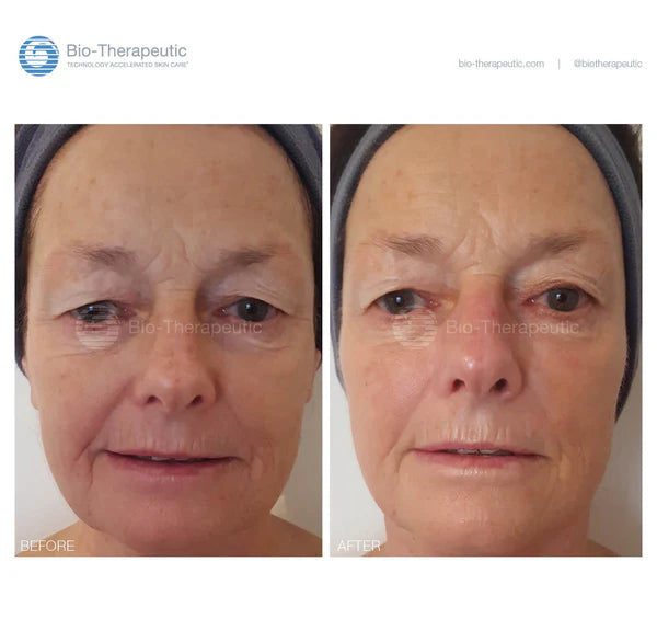 Bio-Ultimate Platinum + FREE bt-sculpt PRO package