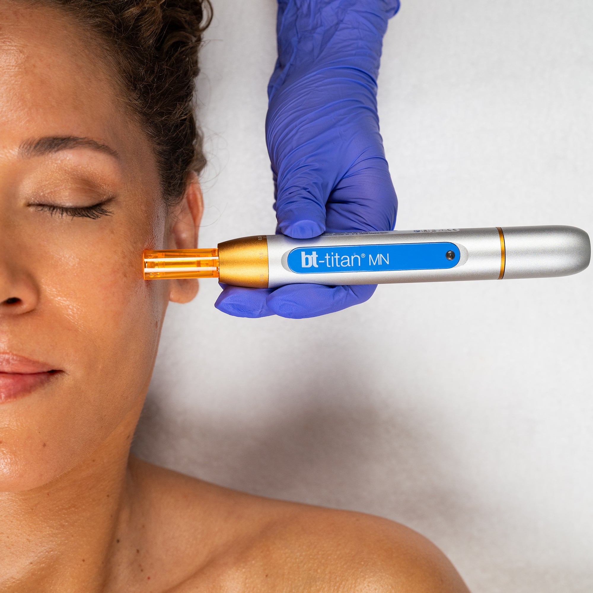 bt-titan MN Model AE + FREE AquaFuse Tech Peel 4oz + Nano Tip