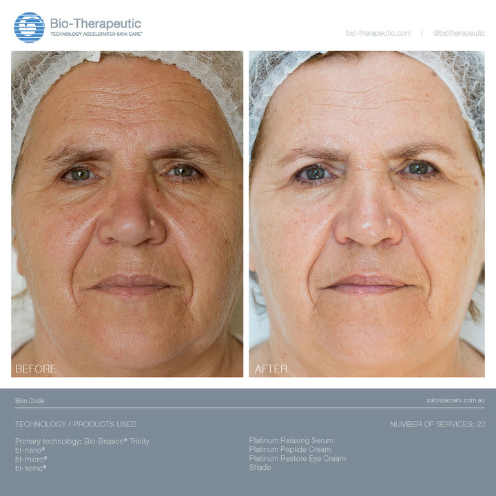 Bio-Brasion Trinity